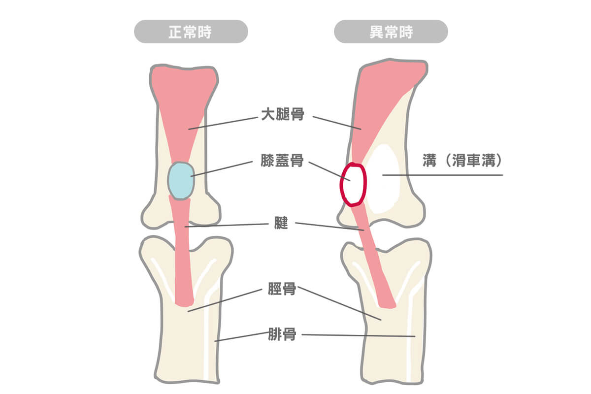 膝蓋骨（パテラ）脱臼とは